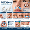 Dilatador Nasal Interno – Abridor de Nariz para Melhor Respiração Nasal | 